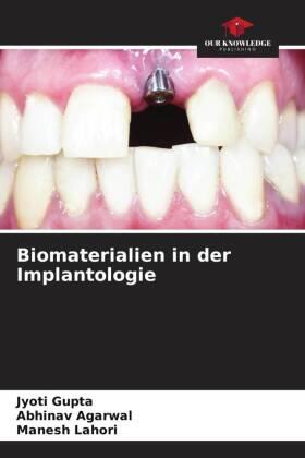 Gupta / Agarwal / Lahori |  Biomaterialien in der Implantologie | Buch |  Sack Fachmedien