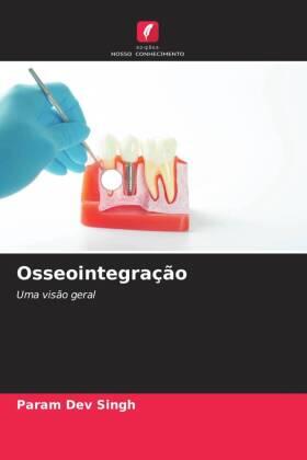 Singh / Kumar / Arya |  Osseointegração | Buch |  Sack Fachmedien