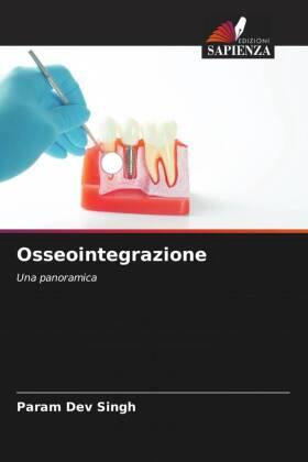Singh / Kumar / Arya |  Osseointegrazione | Buch |  Sack Fachmedien