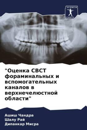 Chandra / Raj / Misra |  "Ocenka CBCT foraminal'nyh i wspomogatel'nyh kanalow w werhnechelüstnoj oblasti" | Buch |  Sack Fachmedien