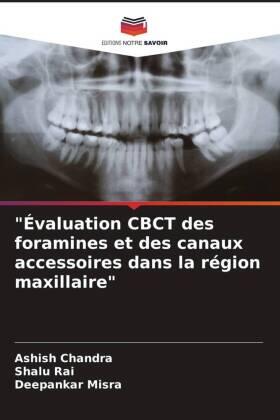 Chandra / Rai / Misra |  "Évaluation CBCT des foramines et des canaux accessoires dans la région maxillaire" | Buch |  Sack Fachmedien