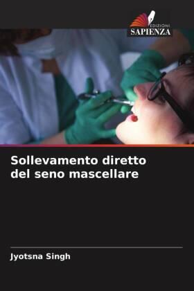 Singh |  Sollevamento diretto del seno mascellare | Buch |  Sack Fachmedien