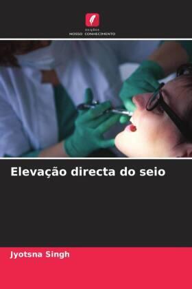 Singh |  Elevação directa do seio | Buch |  Sack Fachmedien