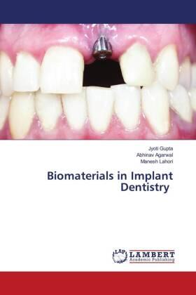 Gupta / Agarwal / Lahori |  Biomaterials in Implant Dentistry | Buch |  Sack Fachmedien