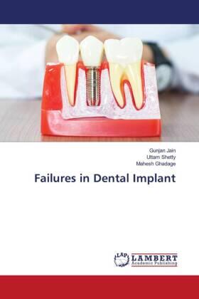 Jain / Shetty / Ghadage |  Failures in Dental Implant | Buch |  Sack Fachmedien