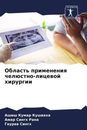 Kushwaha / Rana / Singh |  Oblast' primeneniq chelüstno-licewoj hirurgii | Buch |  Sack Fachmedien