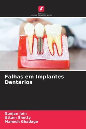 Jain / Shetty / Ghadage |  Falhas em Implantes Dentários | Buch |  Sack Fachmedien