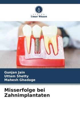 Jain / Shetty / Ghadage |  Misserfolge bei Zahnimplantaten | Buch |  Sack Fachmedien