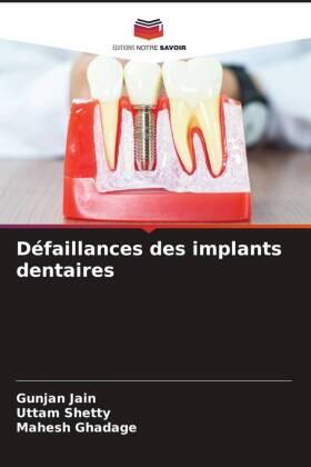 Jain / Shetty / Ghadage |  Défaillances des implants dentaires | Buch |  Sack Fachmedien