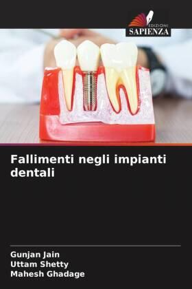 Jain / Shetty / Ghadage |  Fallimenti negli impianti dentali | Buch |  Sack Fachmedien
