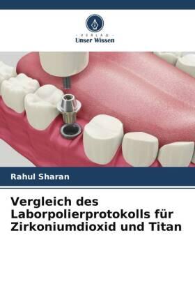 Sharan |  Vergleich des Laborpolierprotokolls für Zirkoniumdioxid und Titan | Buch |  Sack Fachmedien