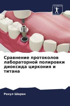 Sharan |  Srawnenie protokolow laboratornoj polirowki dioxida cirkoniq i titana | Buch |  Sack Fachmedien