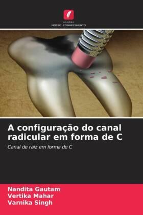 Gautam / Mahar / Singh |  A configuração do canal radicular em forma de C | Buch |  Sack Fachmedien