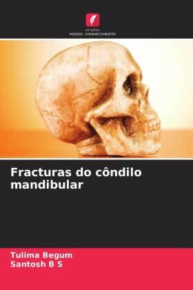 Begum / B S |  Fracturas do côndilo mandibular | Buch |  Sack Fachmedien