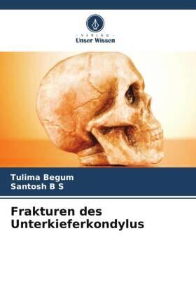 Begum / B S |  Frakturen des Unterkieferkondylus | Buch |  Sack Fachmedien