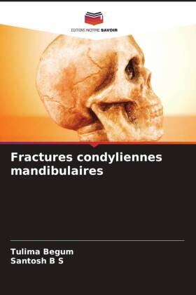 Begum / B S |  Fractures condyliennes mandibulaires | Buch |  Sack Fachmedien