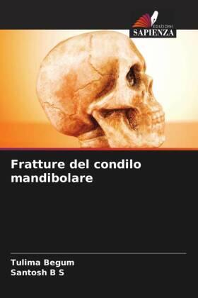 Begum / B S |  Fratture del condilo mandibolare | Buch |  Sack Fachmedien