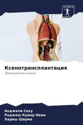 Sahu / Nema / Sharma | Xenotransplantaciq | Buch | 978-620-5-15422-9 | www.sack.de