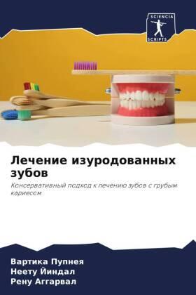 Pupneq / Jindal / Aggarwal |  Lechenie izurodowannyh zubow | Buch |  Sack Fachmedien