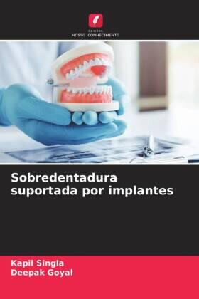 Singla / Goyal |  Sobredentadura suportada por implantes | Buch |  Sack Fachmedien