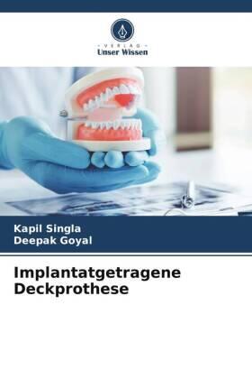 Singla / Goyal |  Implantatgetragene Deckprothese | Buch |  Sack Fachmedien