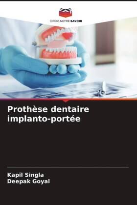 Singla / Goyal |  Prothèse dentaire implanto-portée | Buch |  Sack Fachmedien