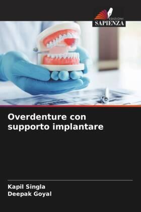 Singla / Goyal |  Overdenture con supporto implantare | Buch |  Sack Fachmedien