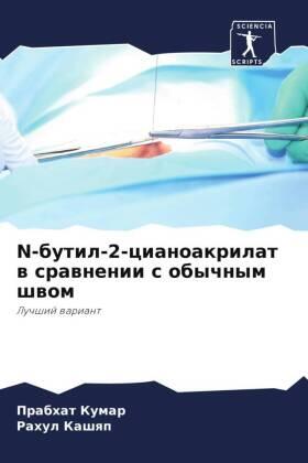 Kumar / Kashqp |  N-butil-2-cianoakrilat w srawnenii s obychnym shwom | Buch |  Sack Fachmedien