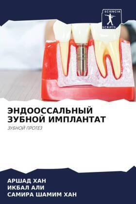 Han / Ali |  JeNDOOSSAL'NYJ ZUBNOJ IMPLANTAT | Buch |  Sack Fachmedien