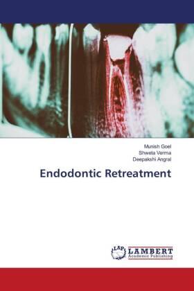 Goel / Verma / Angral | Endodontic Retreatment | Buch | 978-620-549011-2 | sack.de