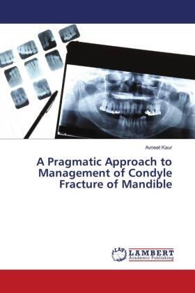 Kaur |  A Pragmatic Approach to Management of Condyle Fracture of Mandible | Buch |  Sack Fachmedien