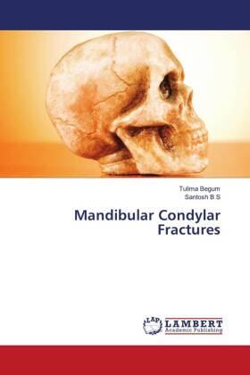 Begum / B S |  Mandibular Condylar Fractures | Buch |  Sack Fachmedien