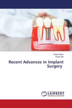 Akolu / Lele |  Recent Advances in Implant Surgery | Buch |  Sack Fachmedien