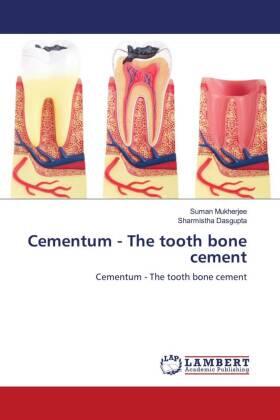 Mukherjee / Dasgupta |  Cementum - The tooth bone cement | Buch |  Sack Fachmedien
