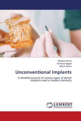Verma / Nagpal |  Unconventional Implants | Buch |  Sack Fachmedien