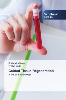 Singh / Unde |  Guided Tissue Regeneration | Buch |  Sack Fachmedien