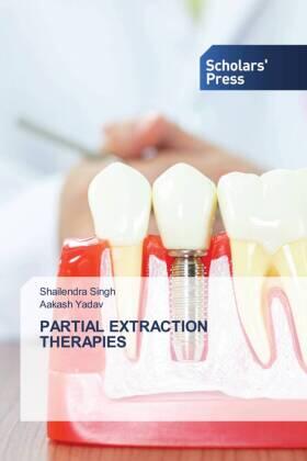 Singh / Yadav |  PARTIAL EXTRACTION THERAPIES | Buch |  Sack Fachmedien