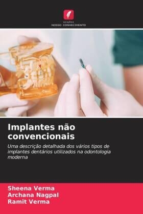 Verma / Nagpal |  Implantes não convencionais | Buch |  Sack Fachmedien