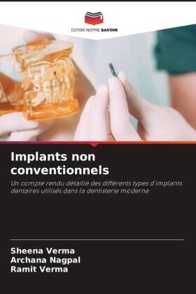 Verma / Nagpal |  Implants non conventionnels | Buch |  Sack Fachmedien