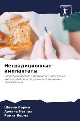 Verma / Nagpal |  Netradicionnye implantaty | Buch |  Sack Fachmedien