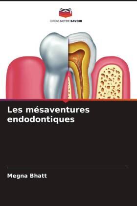 Bhatt |  Les mésaventures endodontiques | Buch |  Sack Fachmedien