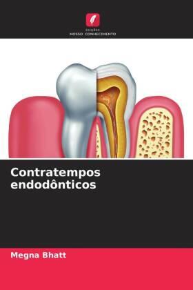 Bhatt |  Contratempos endodônticos | Buch |  Sack Fachmedien