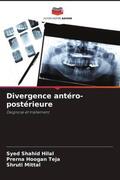 Hilal / Teja / Mittal |  Divergence antéro-postérieure | Buch |  Sack Fachmedien