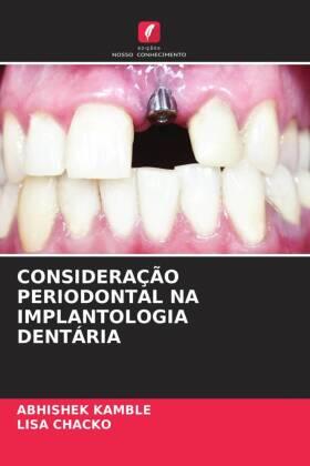 Kamble / Chacko |  CONSIDERAÇÃO PERIODONTAL NA IMPLANTOLOGIA DENTÁRIA | Buch |  Sack Fachmedien