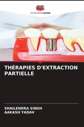 Singh / Yadav |  THÉRAPIES D'EXTRACTION PARTIELLE | Buch |  Sack Fachmedien