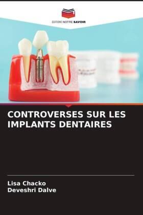 Chacko / Dalve |  CONTROVERSES SUR LES IMPLANTS DENTAIRES | Buch |  Sack Fachmedien