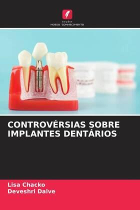 Chacko / Dalve |  CONTROVÉRSIAS SOBRE IMPLANTES DENTÁRIOS | Buch |  Sack Fachmedien