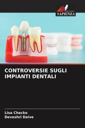 Chacko / Dalve |  CONTROVERSIE SUGLI IMPIANTI DENTALI | Buch |  Sack Fachmedien