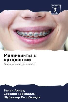 Ahmed / Garepally / Juwwadi |  Mini-winty w ortodontii | Buch |  Sack Fachmedien