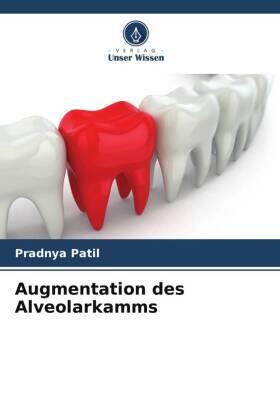 Patil / Agrawal |  Augmentation des Alveolarkamms | Buch |  Sack Fachmedien